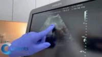 Pro-Life Medical Center Opens in Abortion Capital of the U.S.